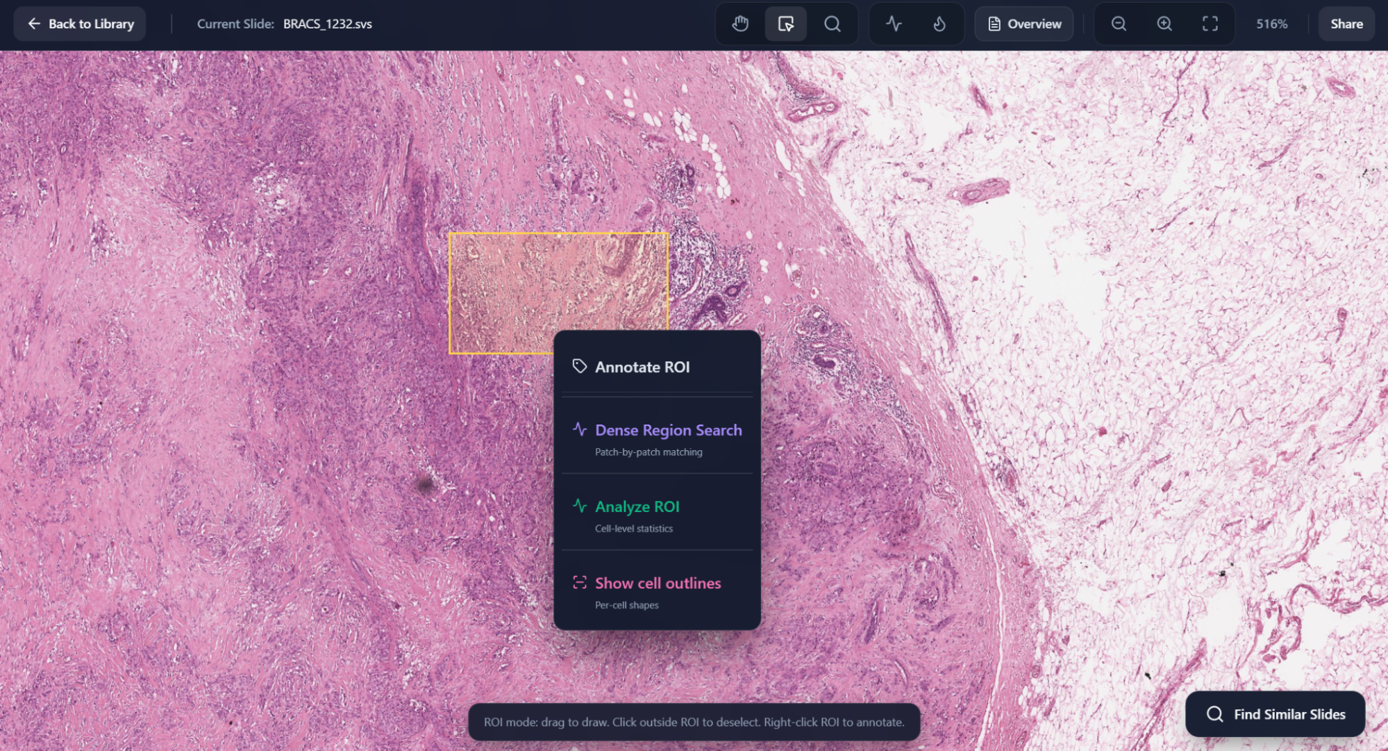 Select Region screenshot
