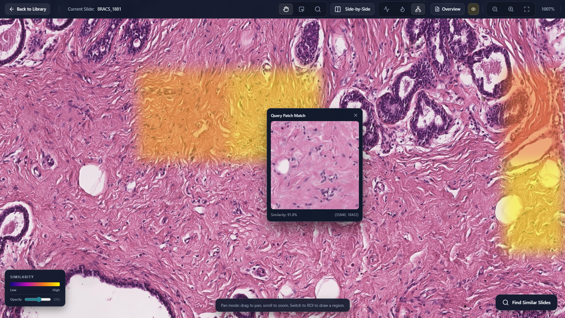Display Matching Query Patch screenshot