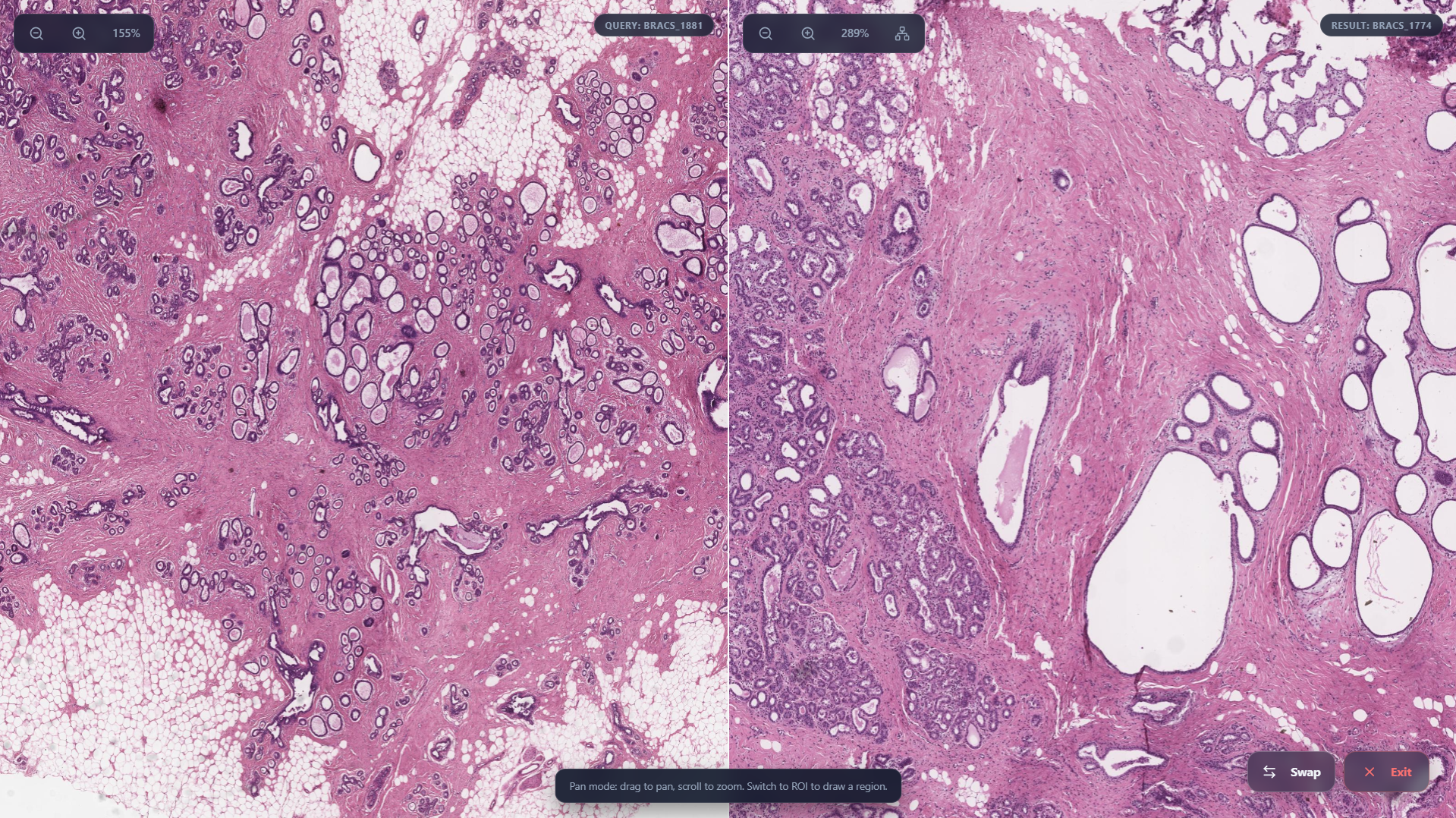 Side By Side View screenshot